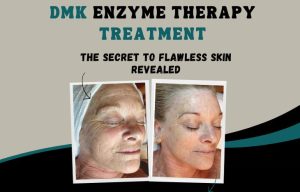 DMK Enzyme Therapy Treatment: The Secret to Flawless Skin Revealed
