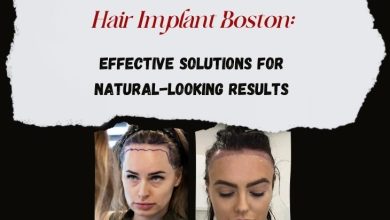 Hair-Implant-Boston-Effective-Solutions-for-Natural-Looking-Results